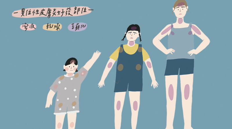 深入淺出探索皮膚免疫疾病