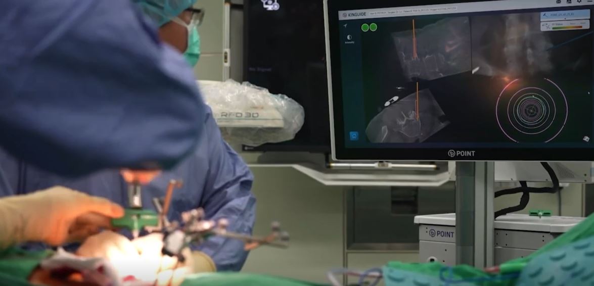 有導航的精準3D微創脊椎手術