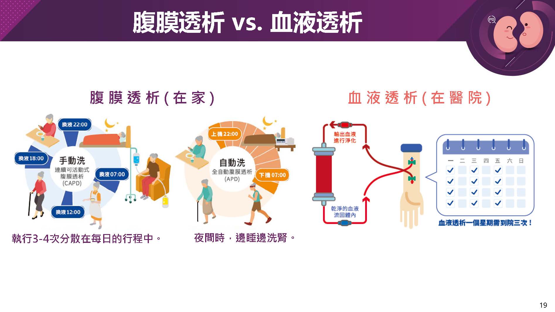 腹膜透析植管新技術，讓緊急洗腎不用等