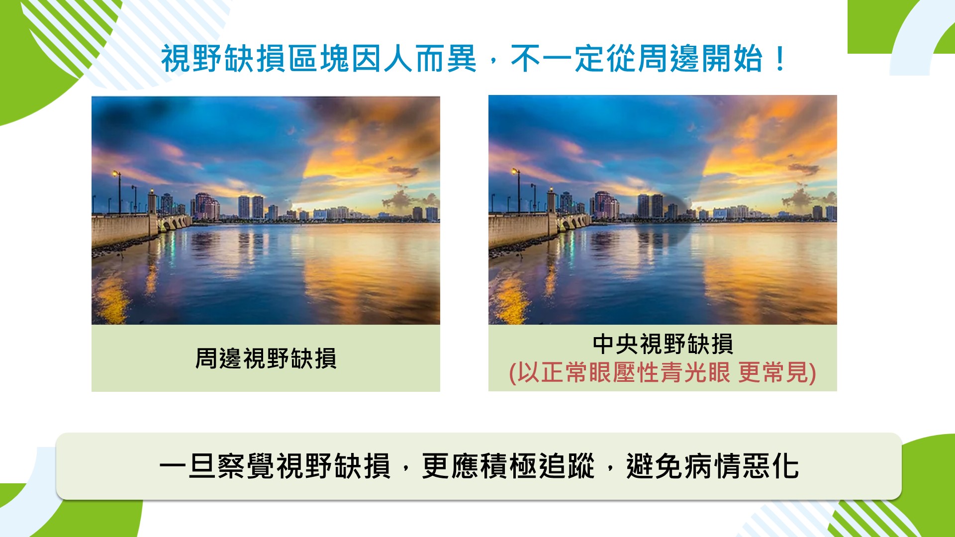 眼壓非青光眼程度指標！新型青光眼微創手術助患者守護視界