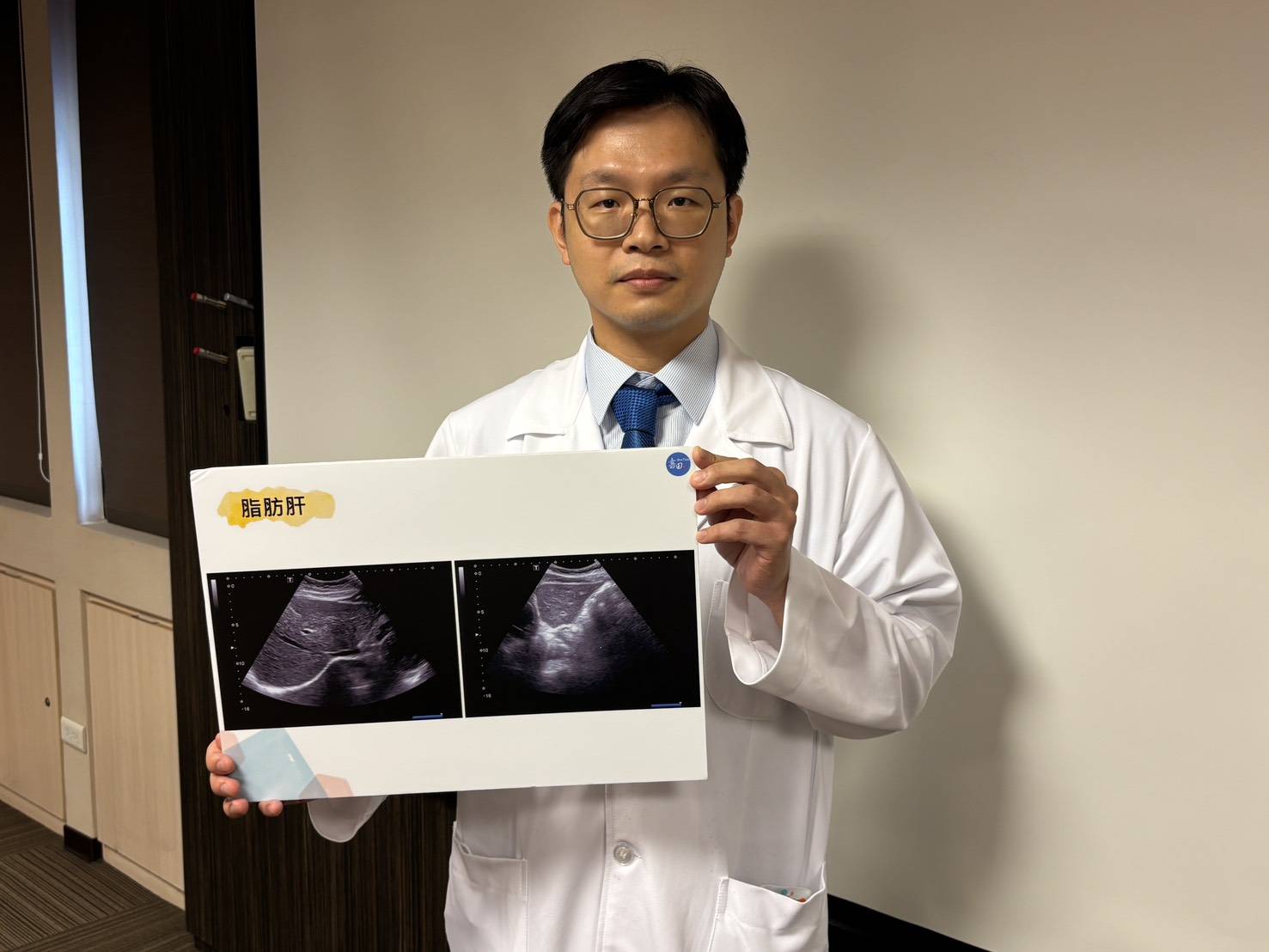 天天喝酒你可能血球變大顆，肝臟拉警報