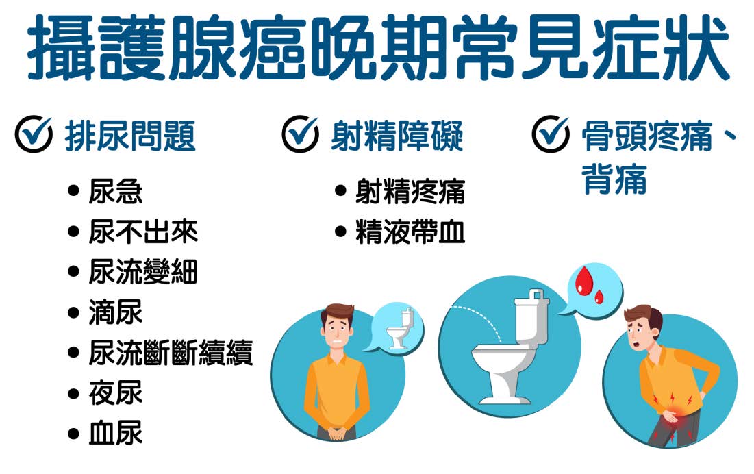 攝護腺癌新療法精準狙擊攝護腺癌