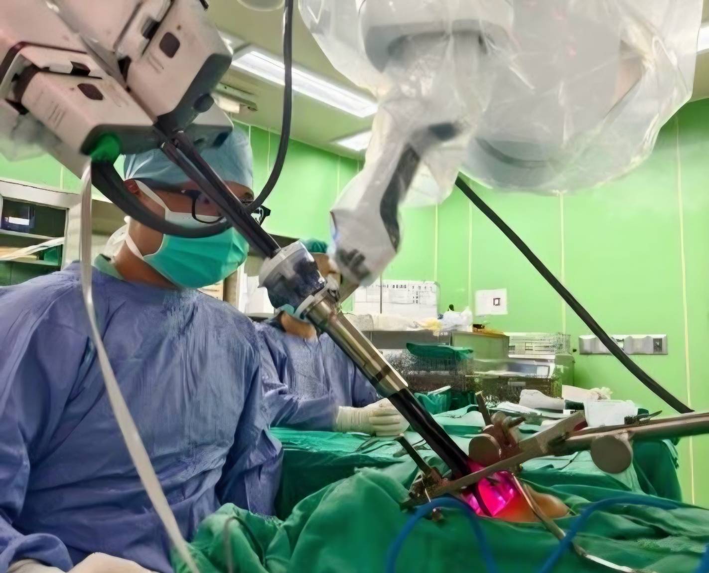 單孔達文西內外複合喉保留手術治療罕見咽喉小唾腺癌