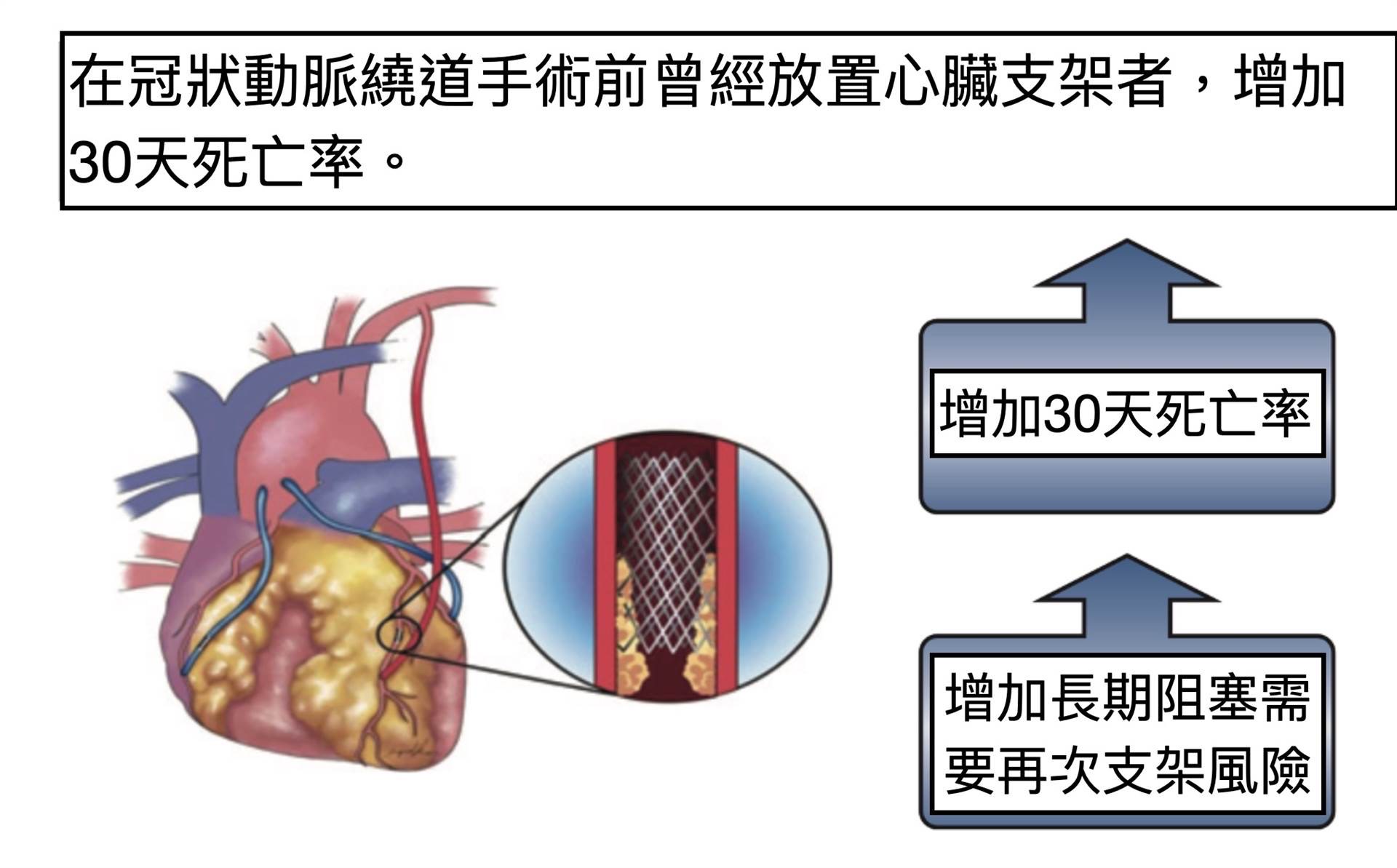 接受冠狀動脈繞道手術前要注意！曾放置心臟支架的術後死亡與再手術風險明顯增加
